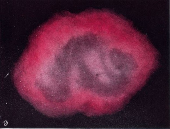 Tình thương nhuộm màu sắc ích kỷ